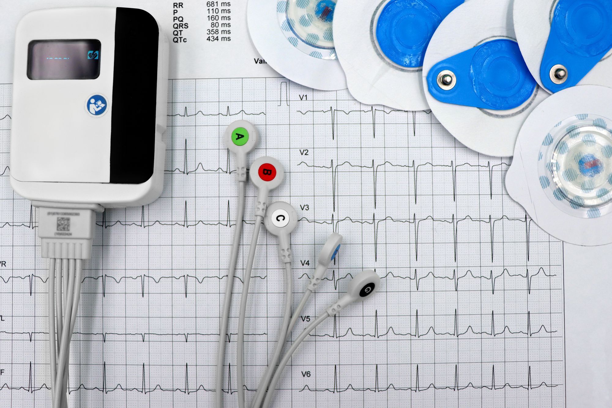 Mobile ECG recorder with leads resting on a printed cardiogram
